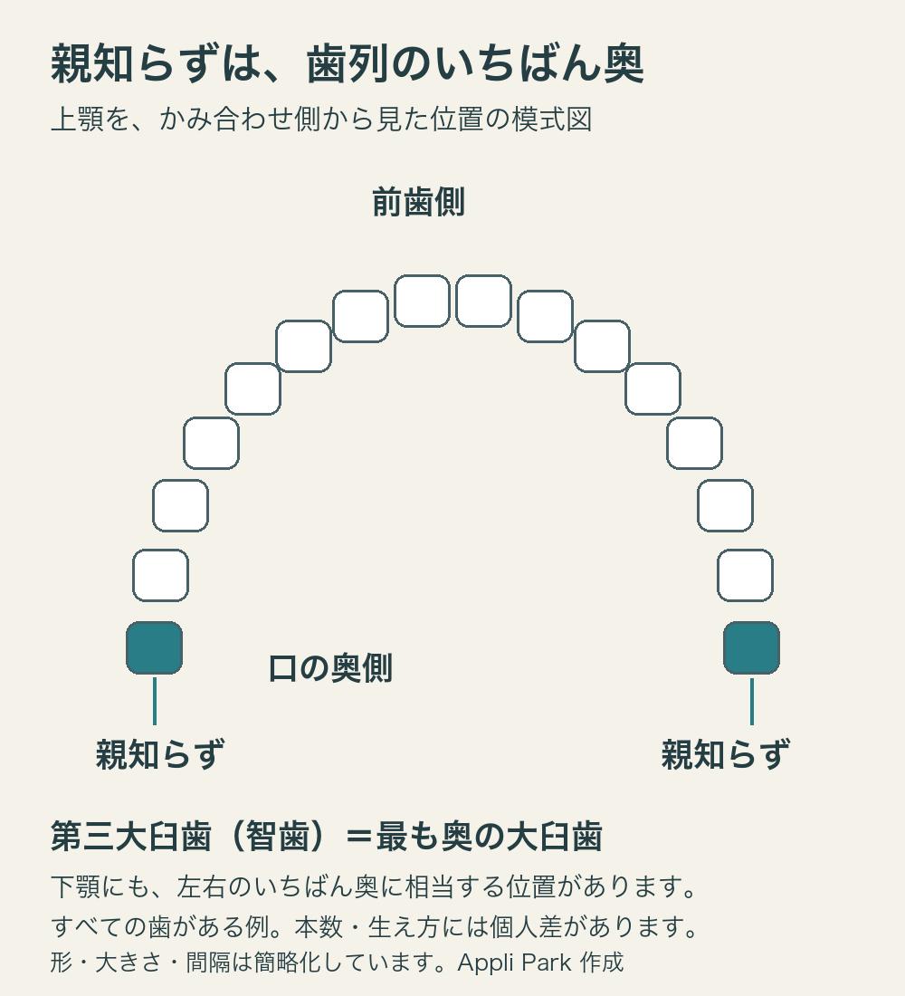 上顎の歯列をかみ合わせ側から見た位置の模式図。16本を記号で示し、左右それぞれの最も奥にある第三大臼歯2本を青緑色で強調。下顎にも左右の最も奥に相当する位置がある。